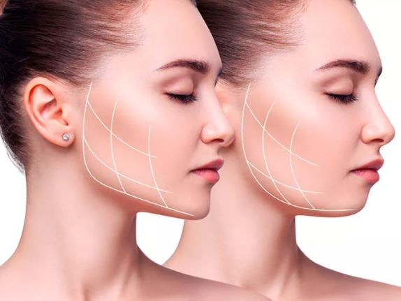 Descubra as Cinco Soluções Transformadoras da Harmonização Facial: O Segredo para uma Aparência Natural